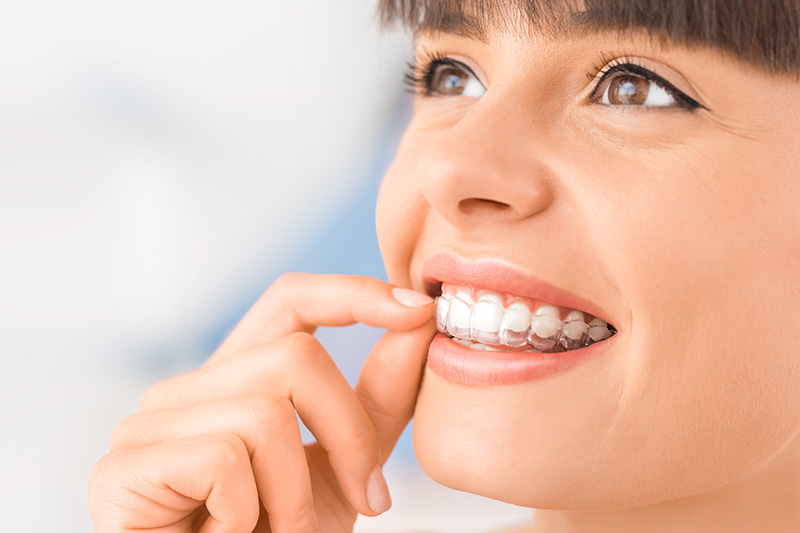 Invisalign in Haverhill