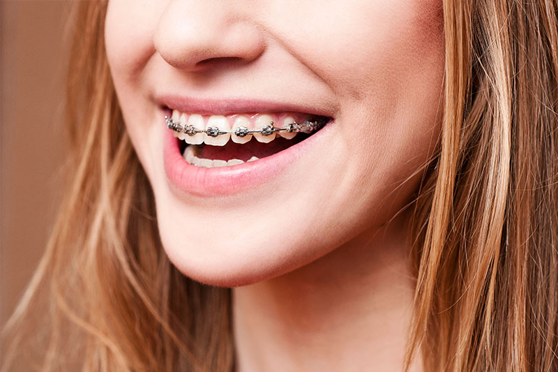 Orthodontics in Haverhill