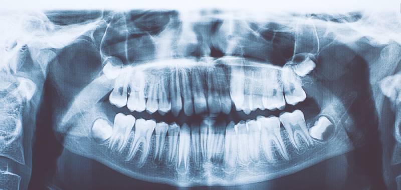 Cone Beam CT Imaging in 